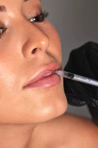 lipfillers